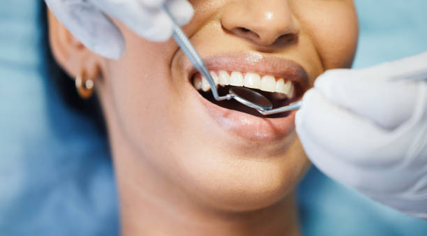 Best Emergency Root Canal Treatment in Binghamton, NY
